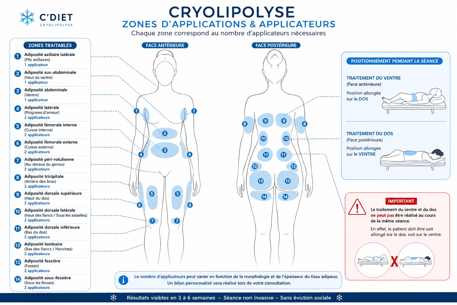 Zones de cryolipolyse traitables chez C'Diet : 14 zones réparties sur les faces antérieure et postérieure, avec le nombre d'applicateurs nécessaires par zone et la règle de positionnement